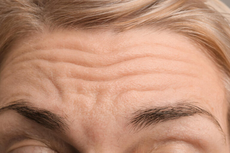 Hydrafacial
