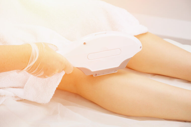 IPL ontharing van benen tijdens professionele behandeling in klinische setting