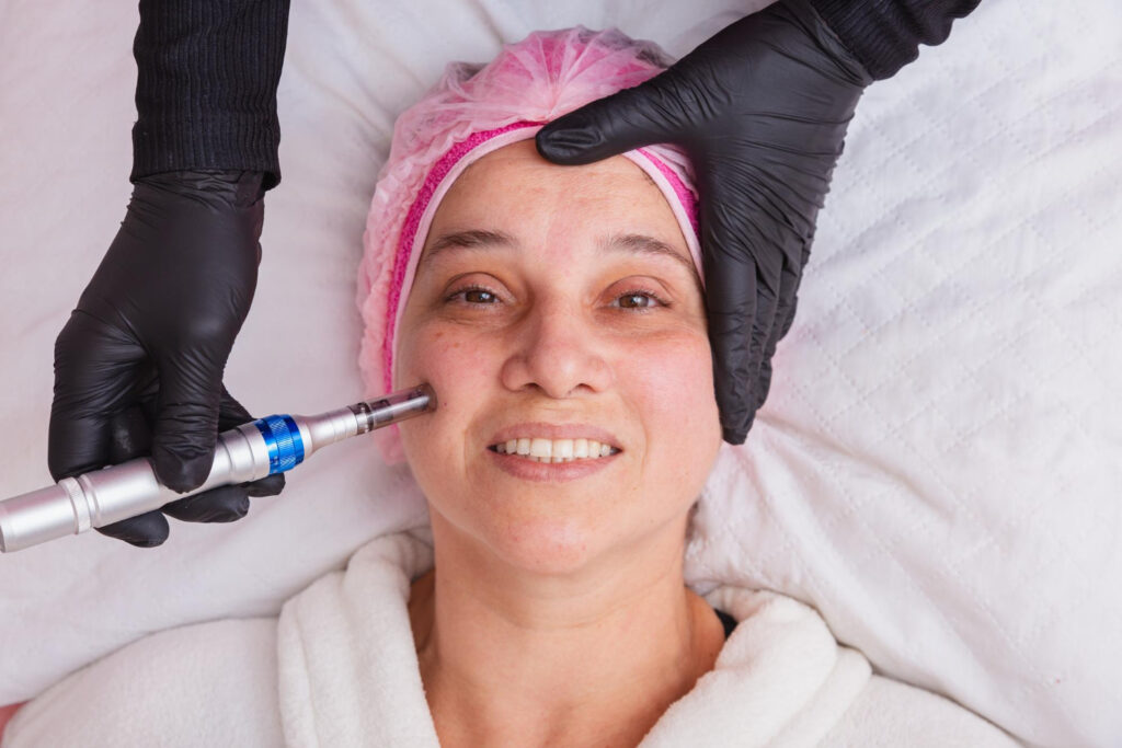 Huidtherapie in Alphen aan den Rijn | Gratis Intake & Advies