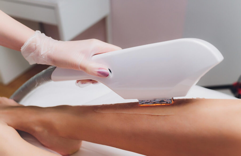 Brazilian wax of Brazilian laseren? Dit is waarom laser de slimste keuze is
