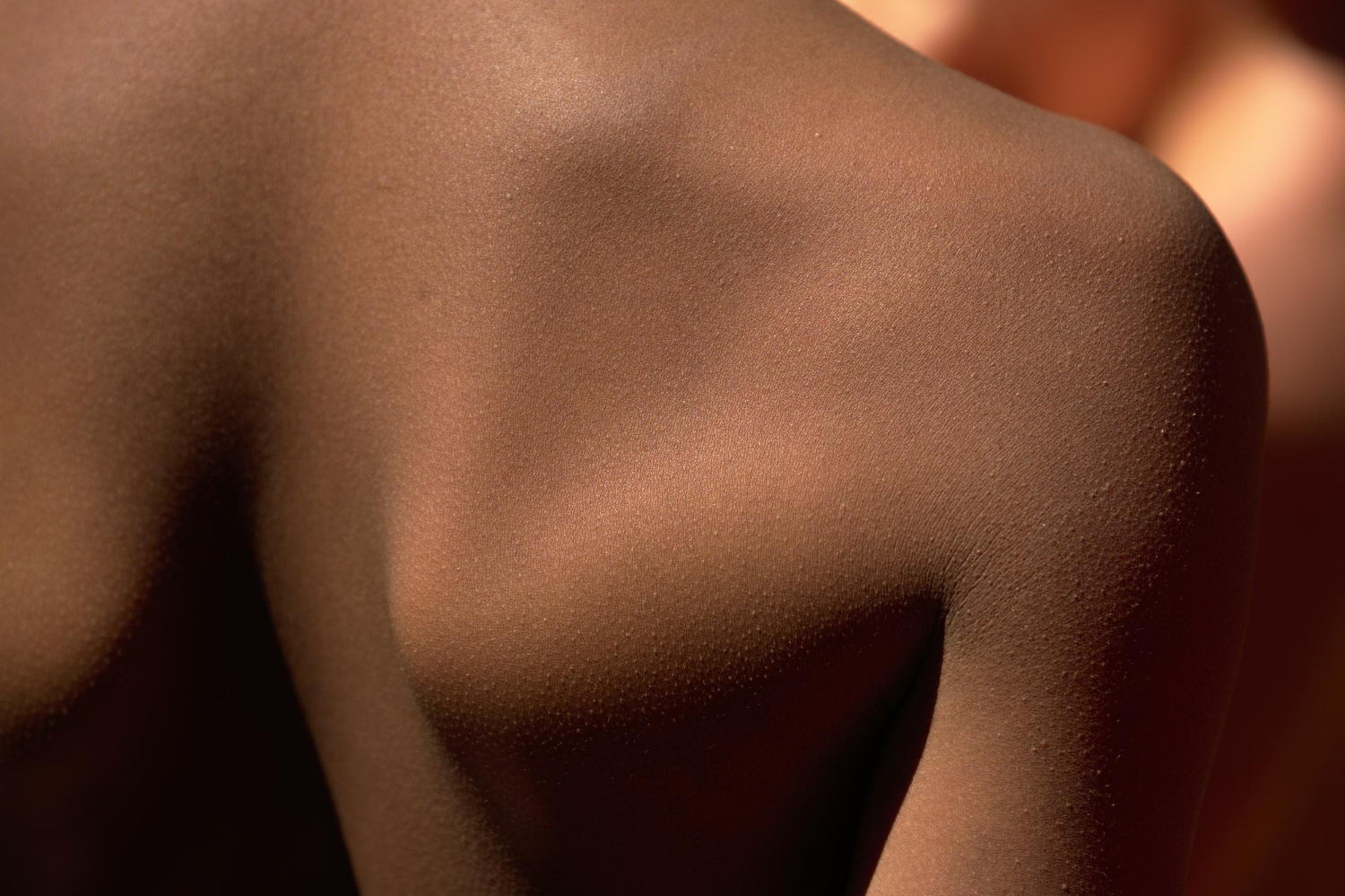 Gladde huid na professionele laser ontharen behandeling – resultaat na volledig traject en inzicht in laser ontharen kosten