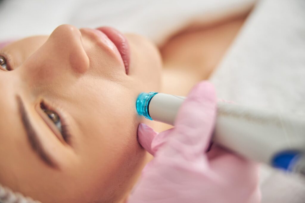 Close-up van een Hydrafacial Deluxe behandeling op de huid, gericht op het verbeteren van de huidstructuur en het verminderen van onzuiverheden in het gezicht