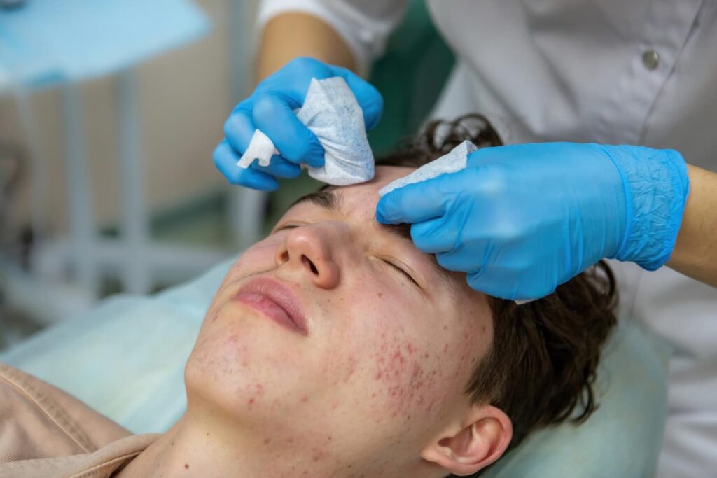 Huidtherapeut behandelt acne bij jongeman in Alphen aan den Rijn — professionele acne behandeling