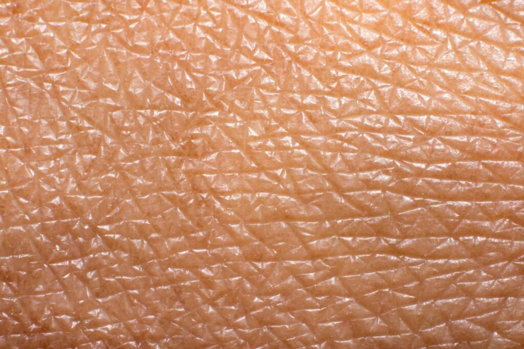 Extreme close-up van glanzende vette huid — zichtbare talgoverproductie als kenmerk van een vette huid