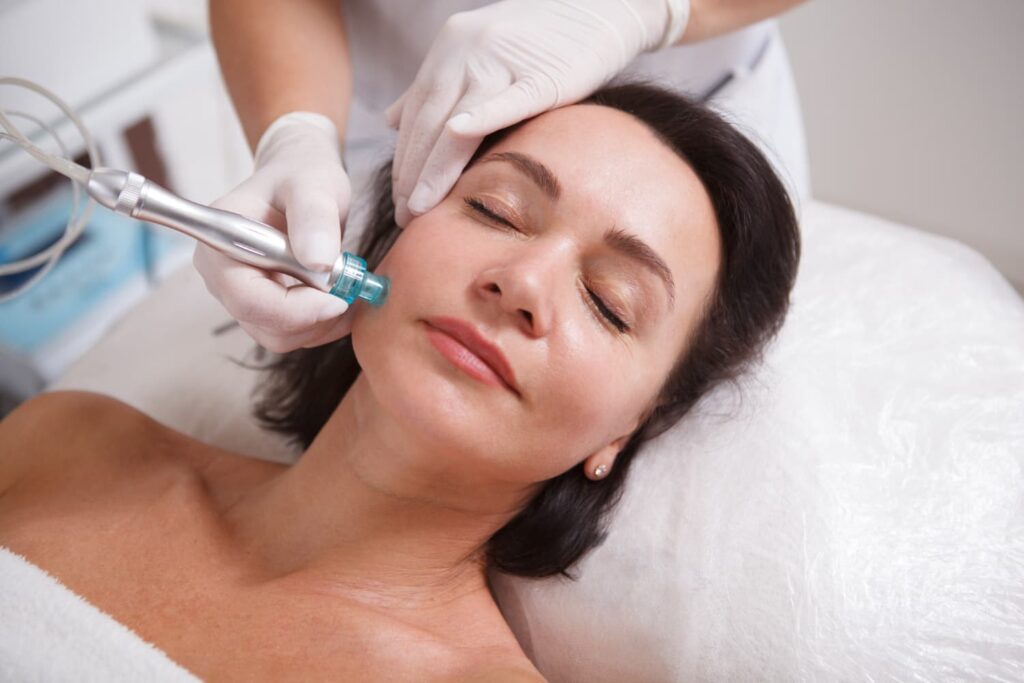 Huidtherapeut voert microneedling uit op wang met apparaat HBO-huidtherapeut behandelt wang met microneedling — behandeling voor cliënten uit Den Haag en omgeving