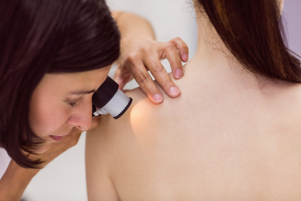 Behandeling van huidoneffenheden bij Huidtherapie van den Berg