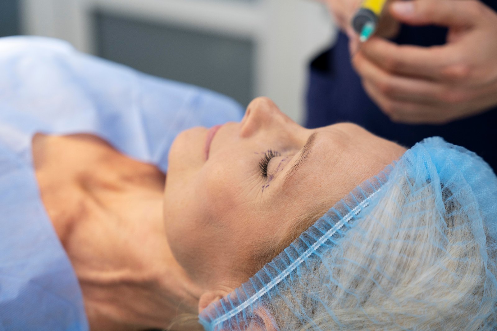 Acnebehandeling gezicht bij milde acne en onzuiverheden voor een rustigere en egalere huid