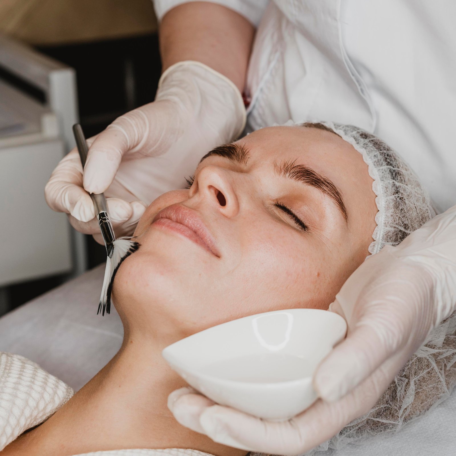Acnebehandeling bij Huidtherapie van den Berg
