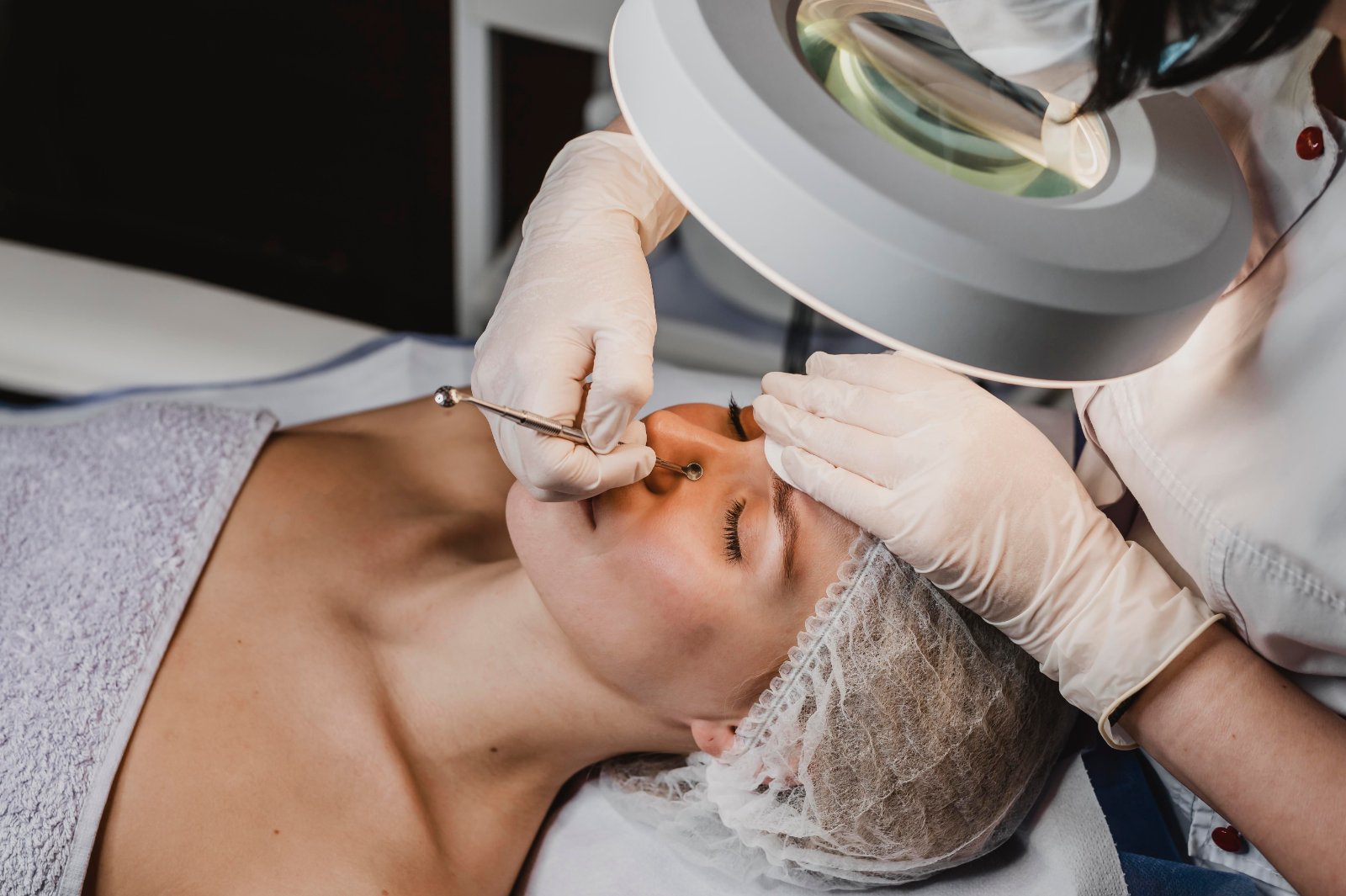 Huidtherapeut behandelt acne professioneel