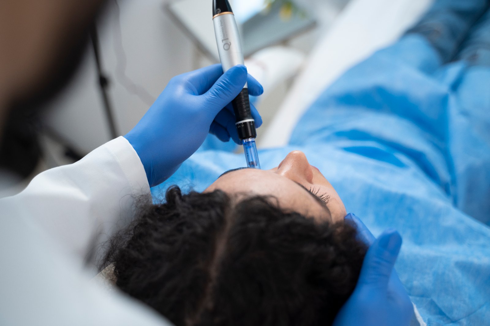 Microneedling Amsterdam bij Huidtherapie van den Berg