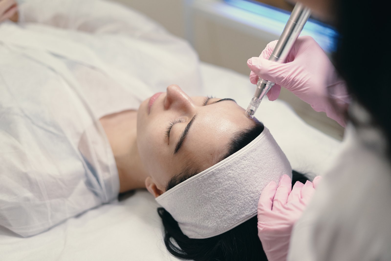 Huidtherapeut voert microneedling uit op wang met apparaat HBO-huidtherapeut behandelt wang met microneedling — behandeling voor cliënten uit Amsterdam en omgeving