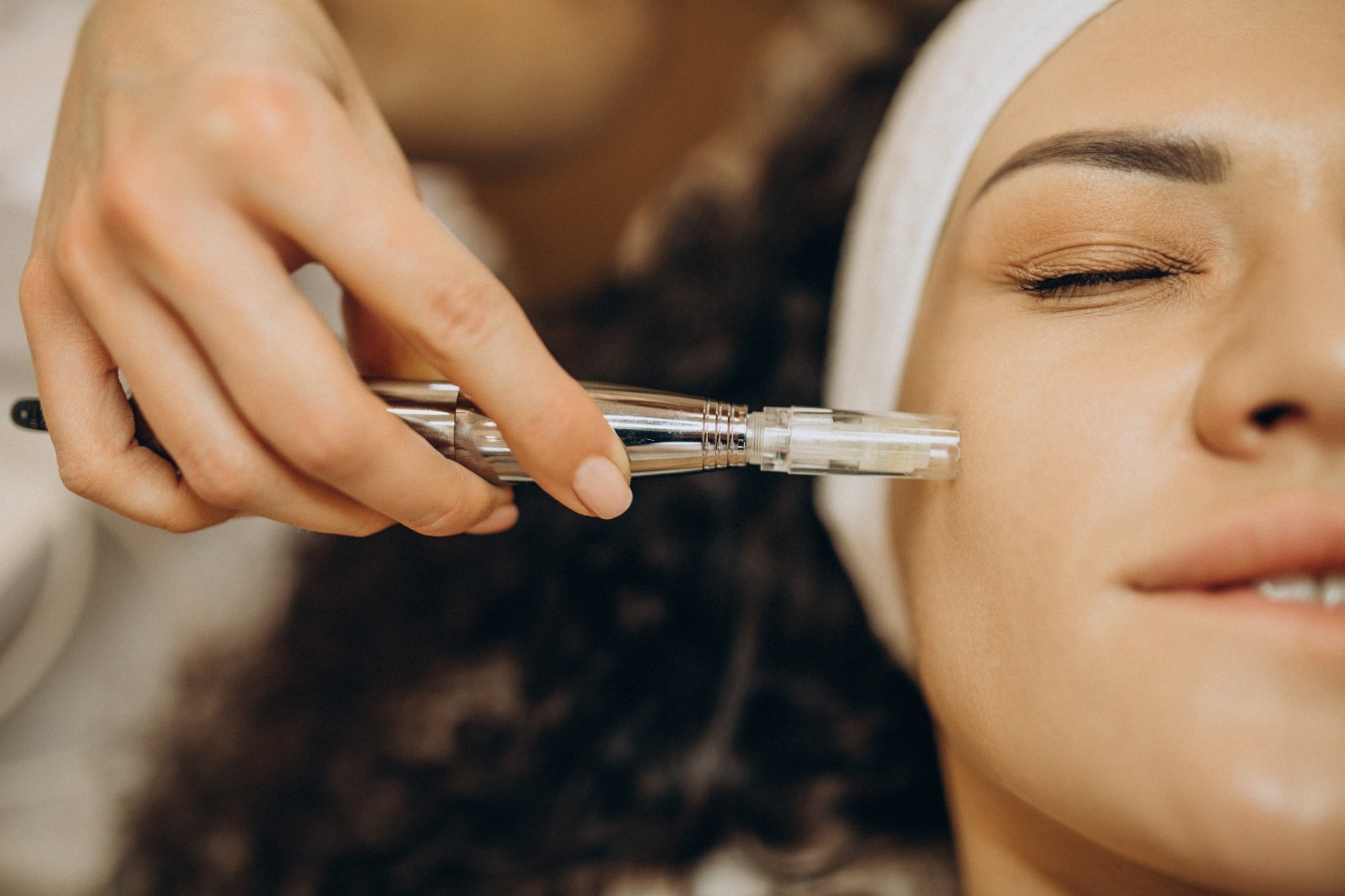 Huidtherapeut past microneedling toe op voorhoofd bij cliënte Microneedling op voorhoofd door ervaren huidtherapeut — microneedling Amsterdam bij Huidtherapie van den Berg