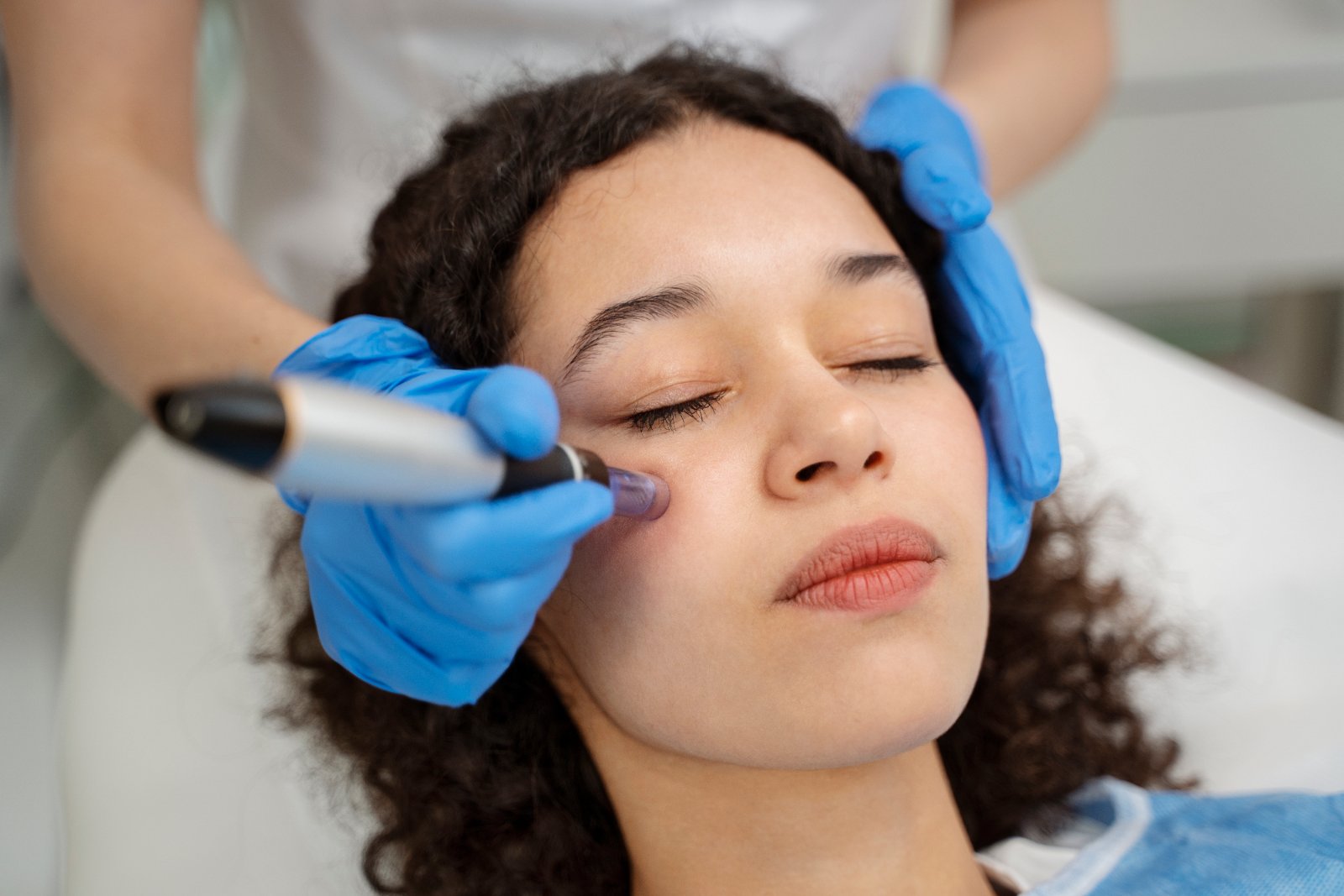 Microneedling Rotterdam bij Huidtherapie van den Berg