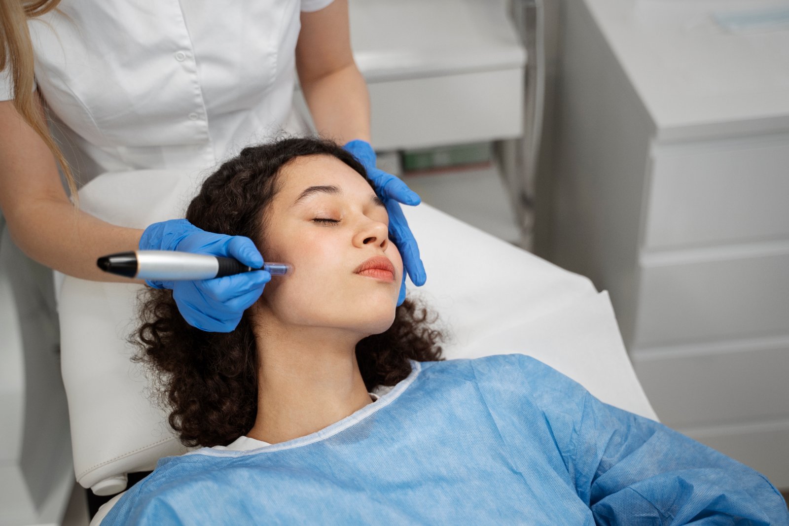 Close-up van een microneedling-behandeling in het gezicht