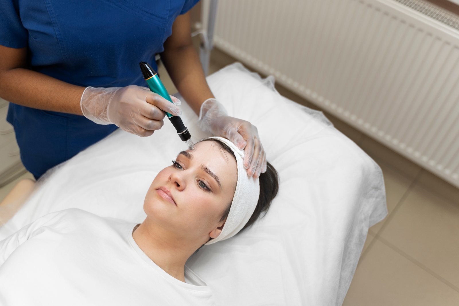 Close-up van een microneedling-behandeling in het gezicht