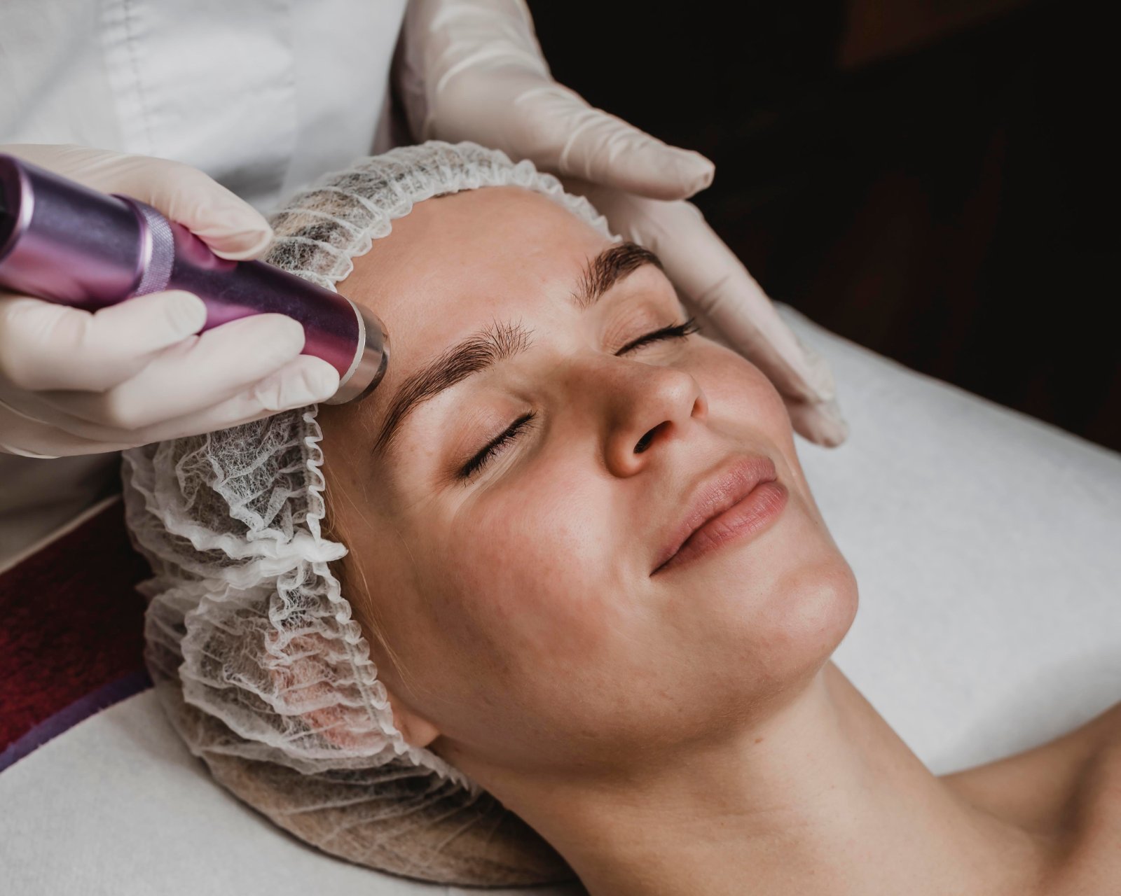 Huidtherapeut past microneedling toe op voorhoofd bij cliënte Microneedling op voorhoofd door ervaren huidtherapeut — microneedling Zoetermeer bij Huidtherapie van den Berg